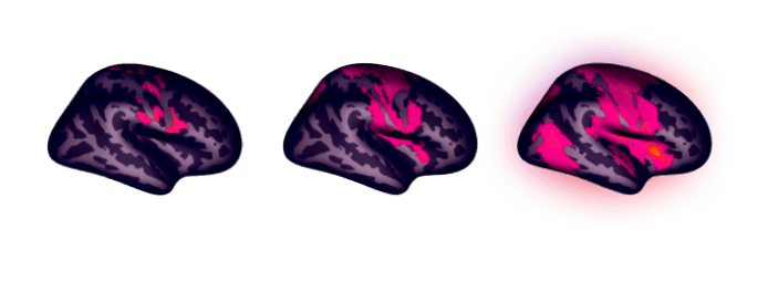 Blood flow in the brain: FMRI studies